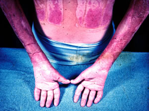 hands protected by gloves